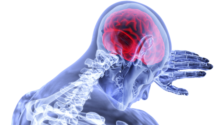 O que é Acidente Vascular Cerebral (AVC), como prevenir e tratar