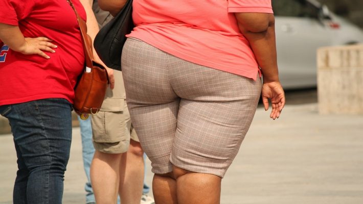 Obesidade: conheça as principais causas e tratamentos