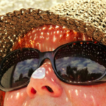 Proteja-se do sol: saiba como evitar o câncer de pele